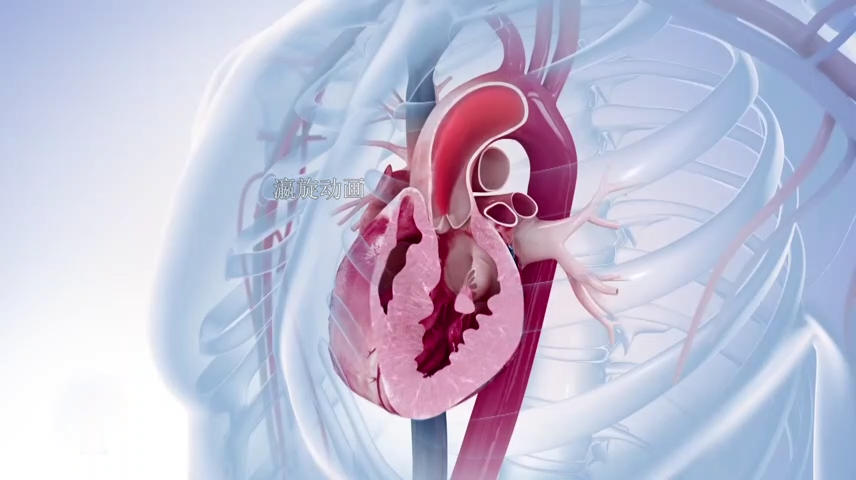 心脏手术三维动画
